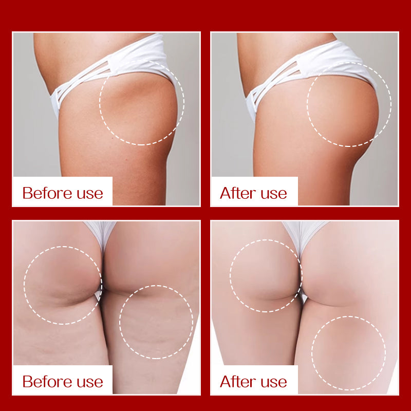 Crema GONGPEI Hip Lift & Firming (60g) – Effetto Push-Up, Rassodante e Sbiancante Glutei
