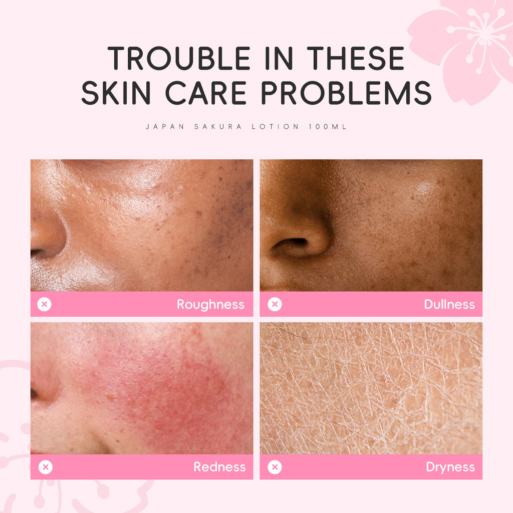 Dr. Roséva Japan Sakura Lotion – Lozione Viso Illuminante ai Fiori di Ciliegio, Vitamina C e Niacinamide (100ml)