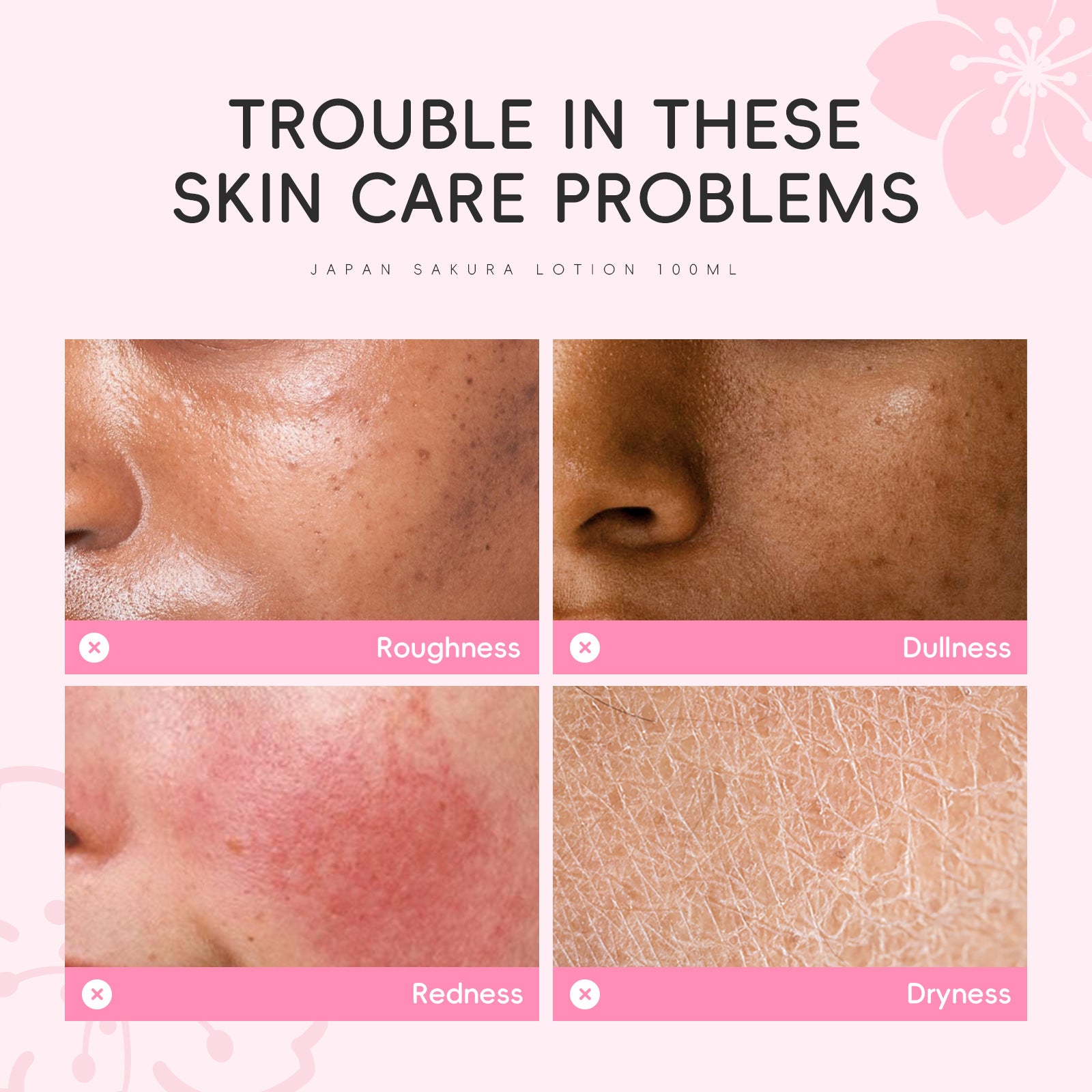 Dr. Roséva Japan Sakura Lotion – Lozione Viso Illuminante ai Fiori di Ciliegio, Vitamina C e Niacinamide (100ml)